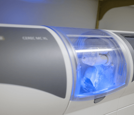 The complete CEREC one visit dentistry system