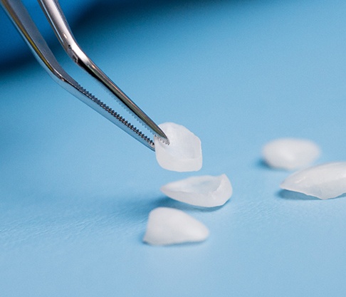 a close-up of dental veneers