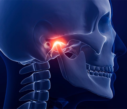 Illustration of human skull with TMJ highlighted in red